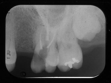 xray scanning, x-ray scanning, negative scanning