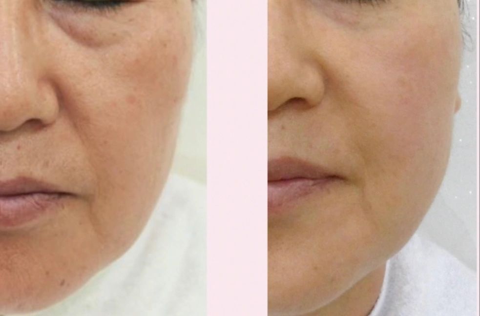 Anti aging treatments in flagstaff