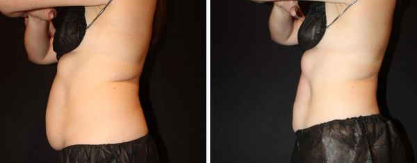 new years resolution