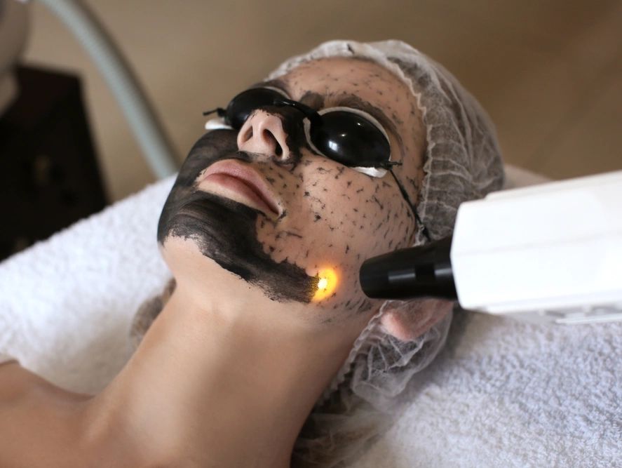 Hollywood LASER peel