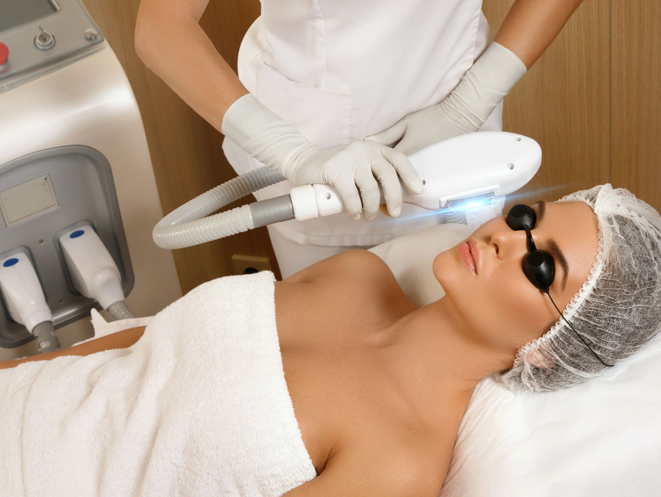 IPL photofacial