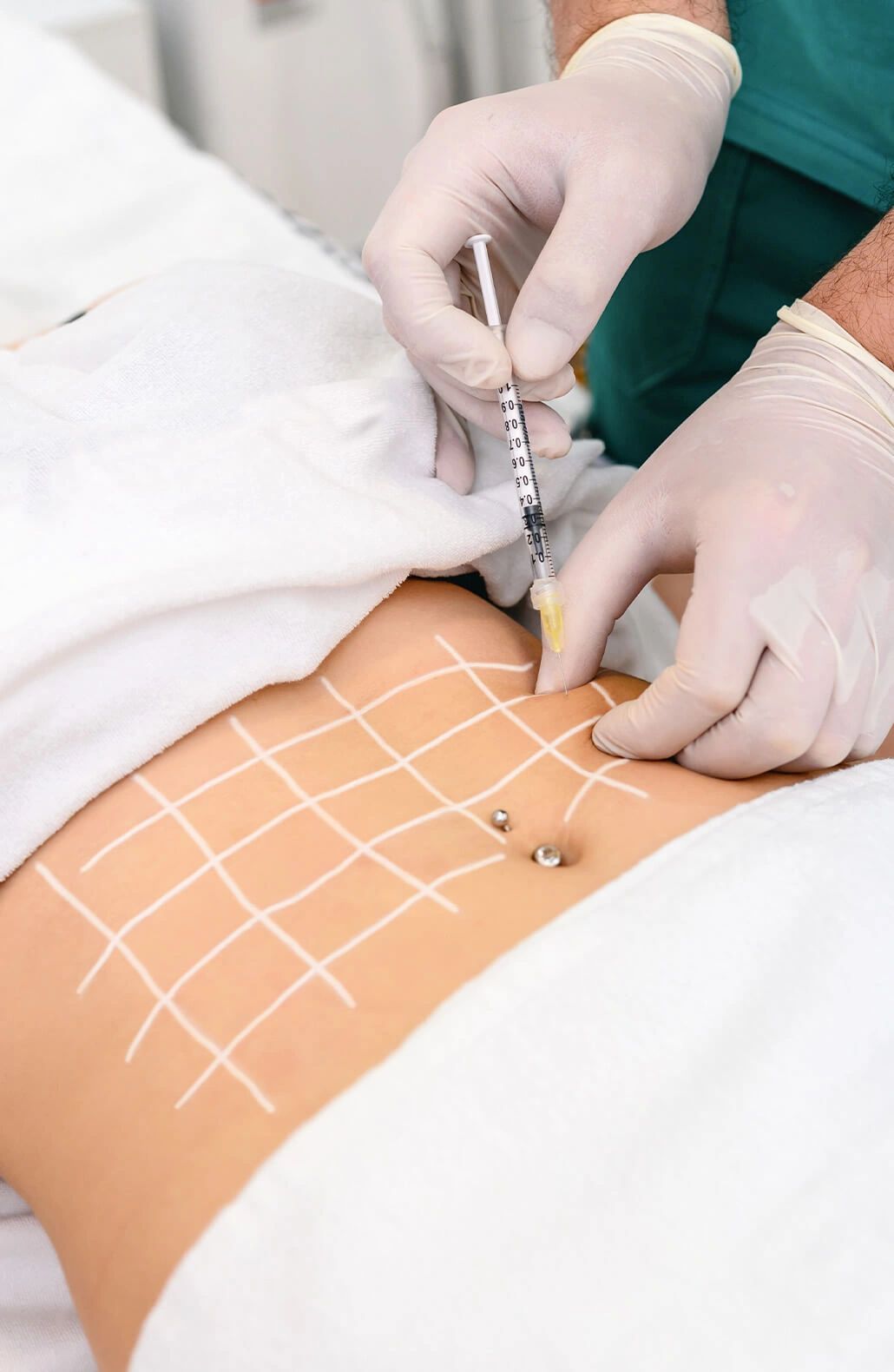 Fat Dissolving Injections: A Non-Surgical Way to Get Rid of Fat