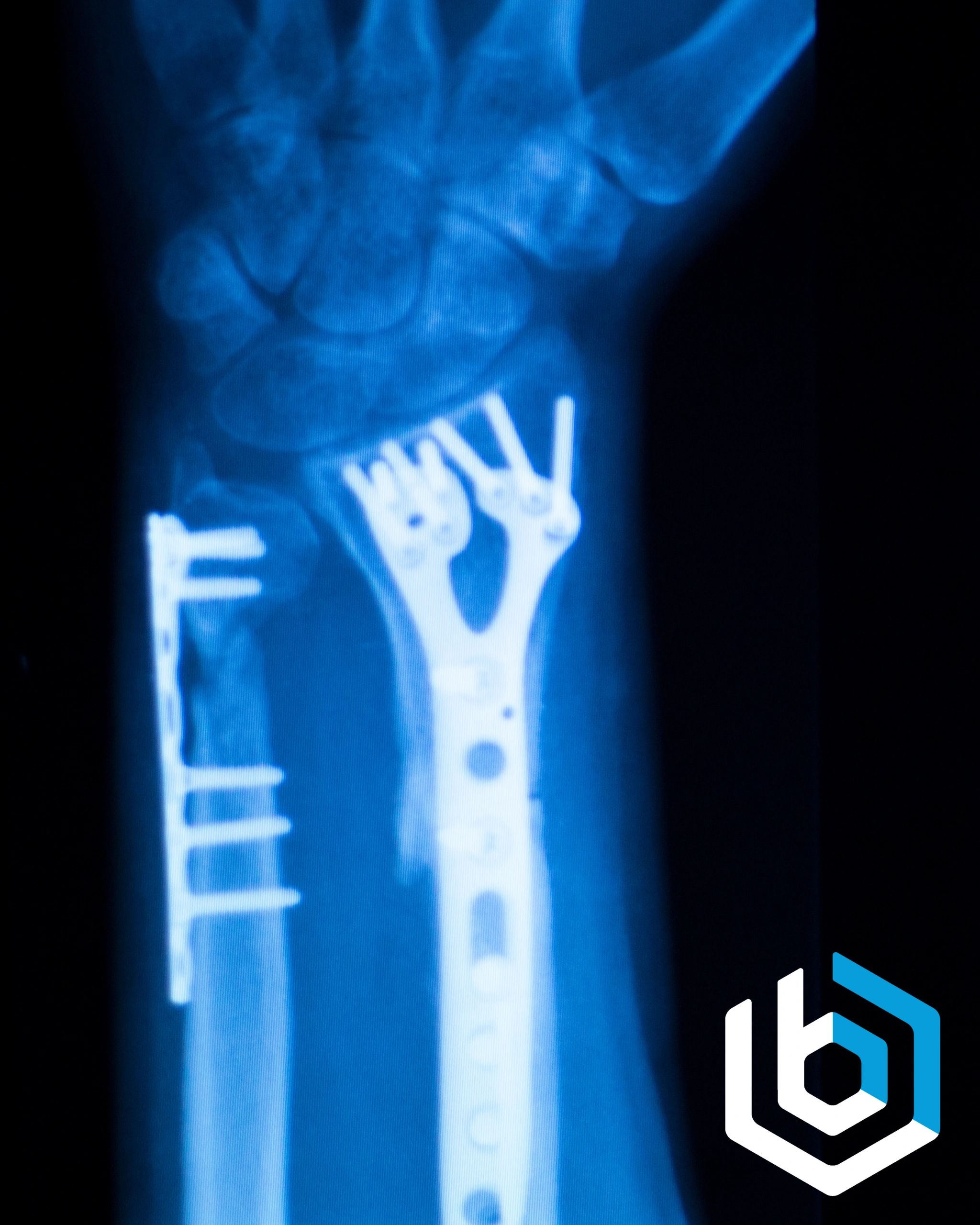 The Role of Prototyping in Medical Device Development