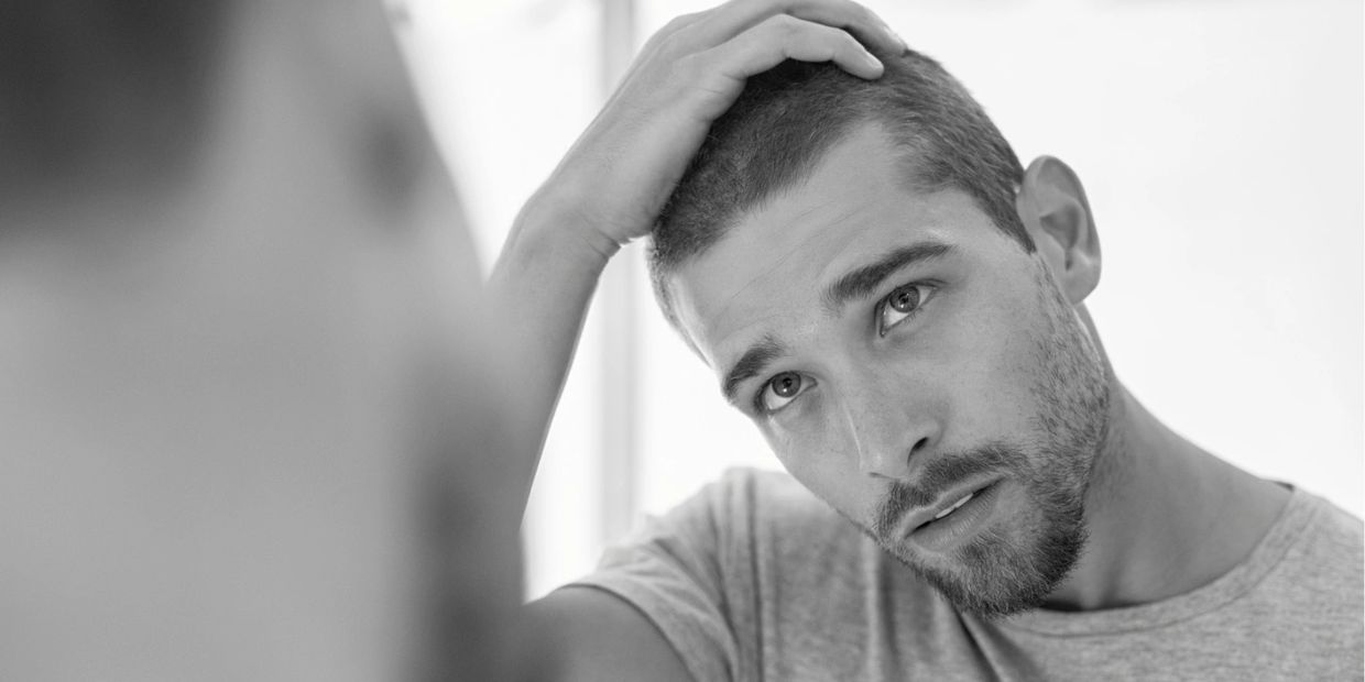 Find treatment options for Male Patterned Balding/Hairloss with Dr J Aesthetics.