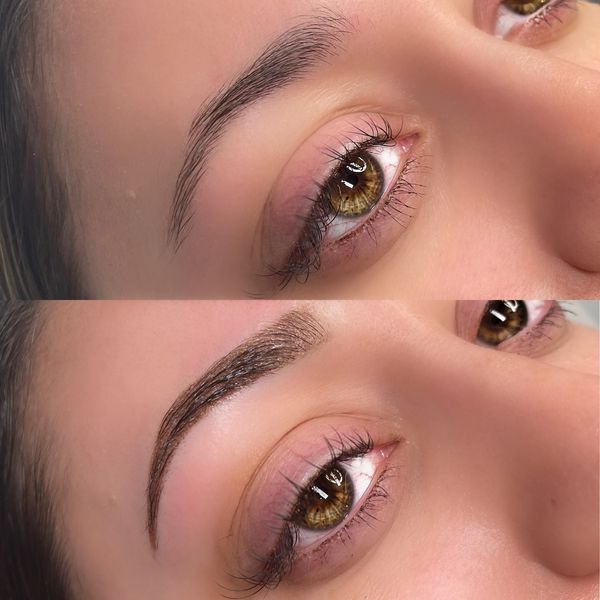 tattoo removal in nj