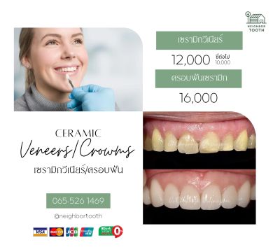 Dental clinic advertisement for ceramic veneers and crowns with pricing and contact info.