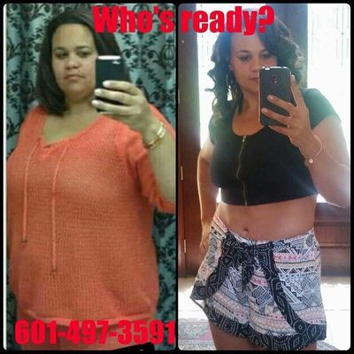 Before and After picture
Healthy Lifestyle Change