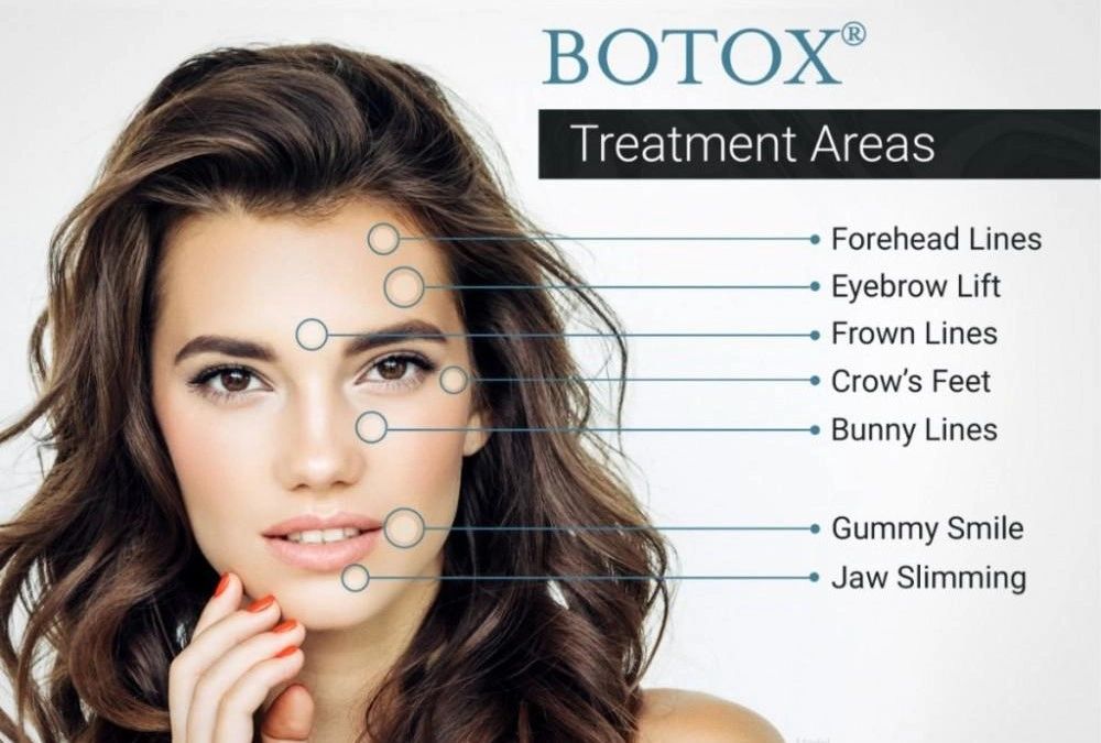 Botox Treatmeant Area