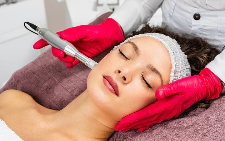 Microneedling procedure with Glutathione