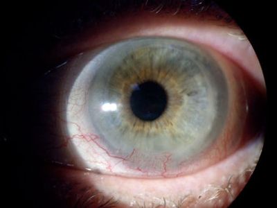 Picture of an eye
