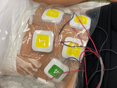 Person with adhesive electrodes attached to abdomen under a transparent plastic sheet.