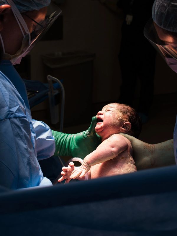 Doula supported C-Section
Life's First Light" by Boundless Grace Birth Photography (D.Swan)