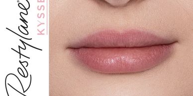 Restylane Kysse logo and woman's lips