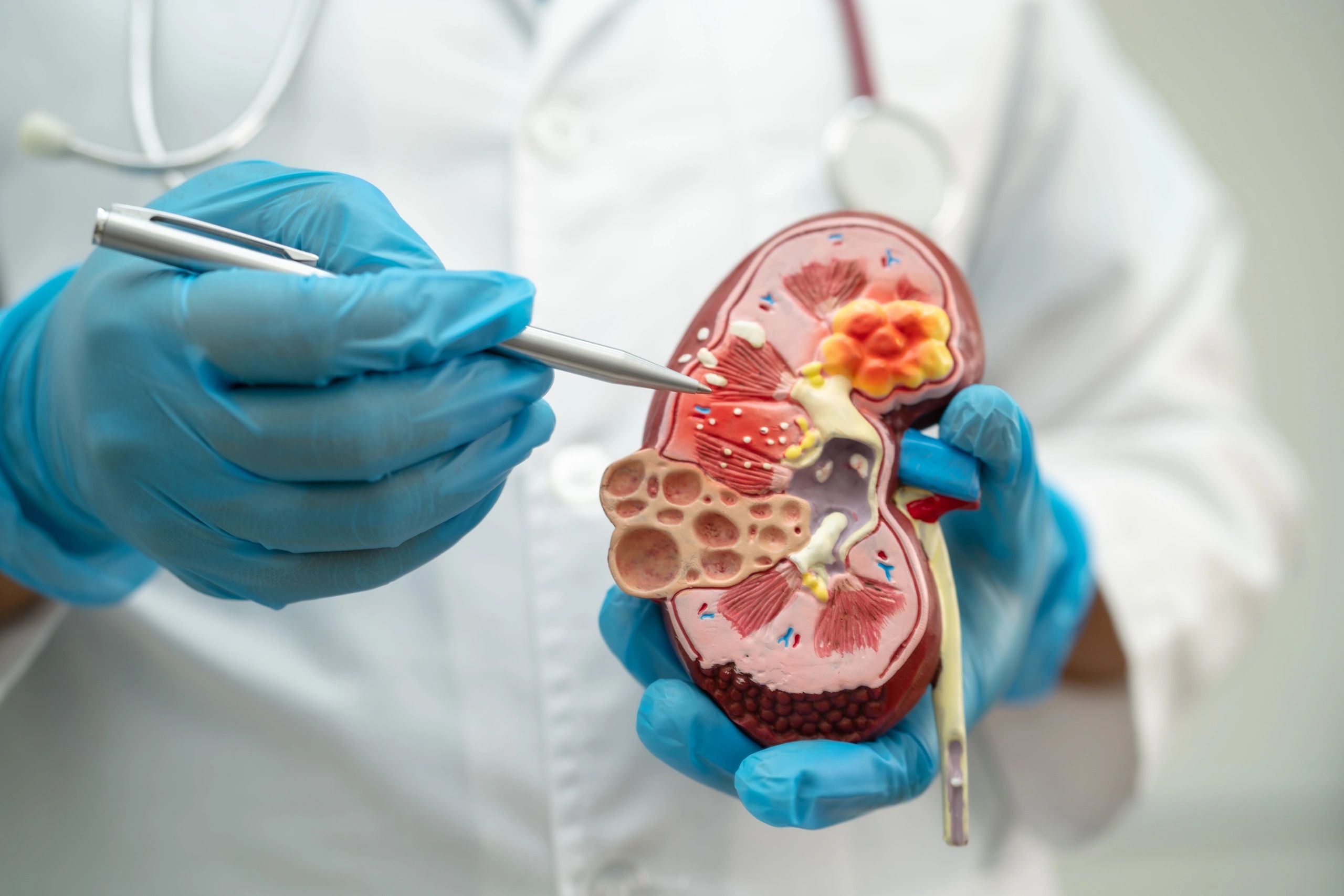Chronic kidney disease