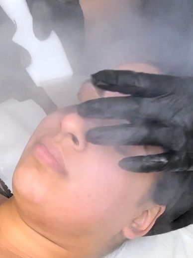 Hydrafacial