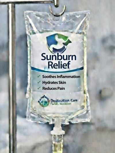 IV bag labeled 'Sunburn Relief' for soothing inflammation and pain.