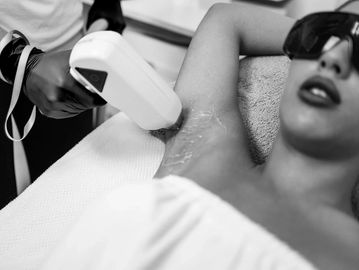 Painless Laser Hair Removal