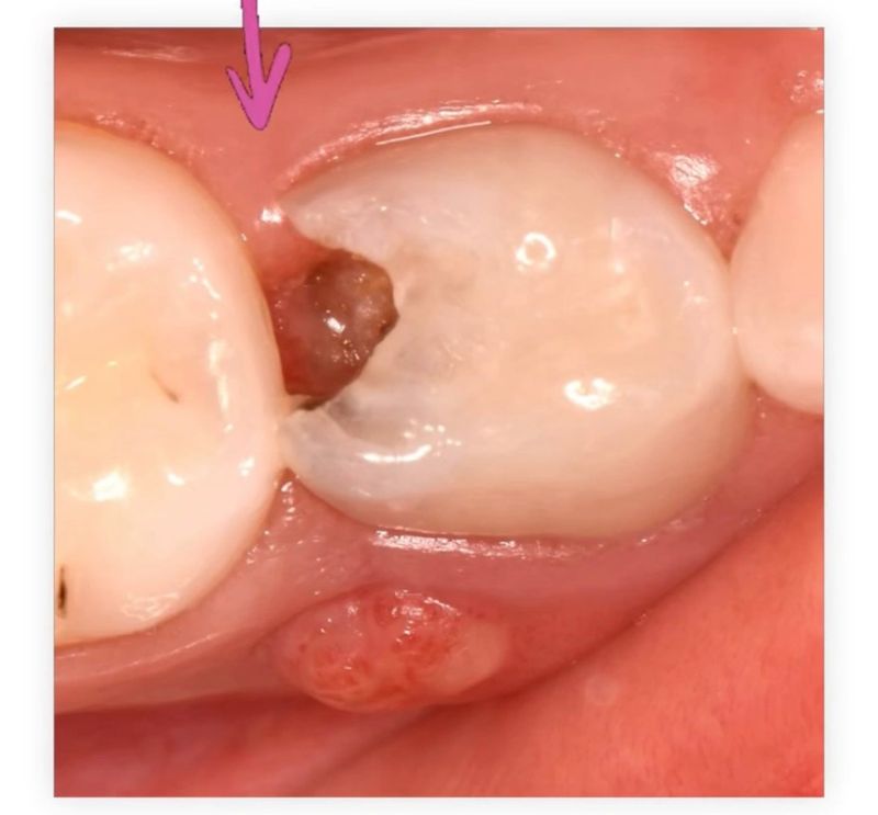 Exploración con tecnología