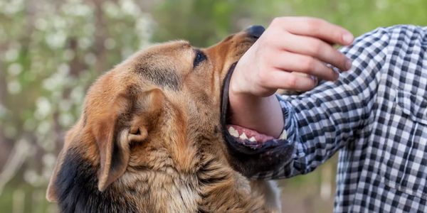 Abogado de Mordida de Perro en Orange County, Mordida de Perro, Accidente de Mordida de Perro,Ataque