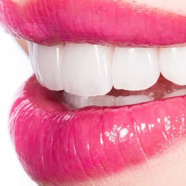 Close-up of bright pink lips and white teeth.