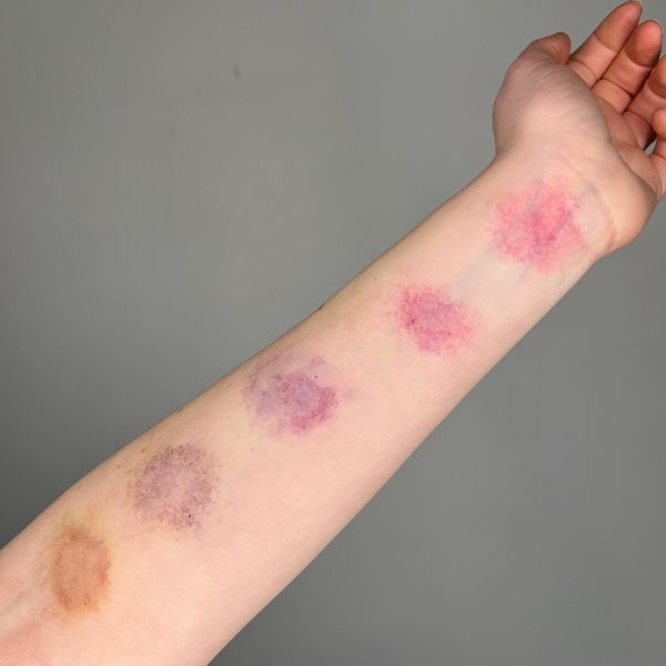 Bruise Makeup