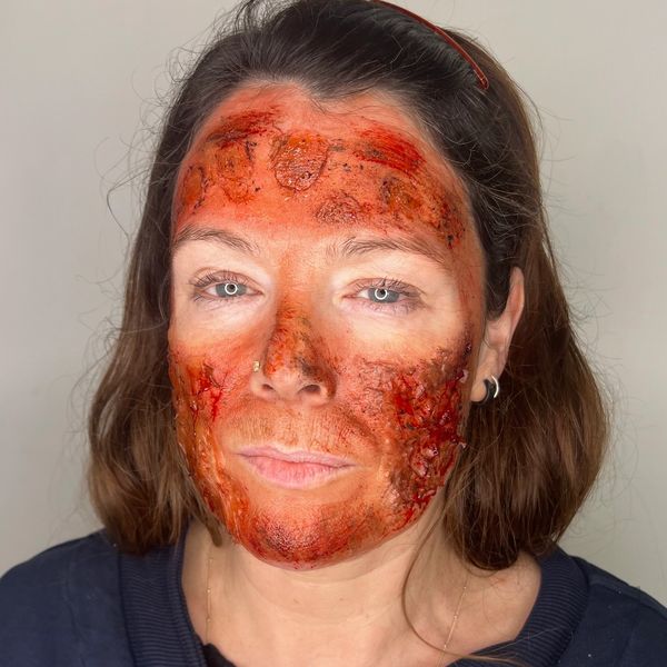 Sunburn Makeup