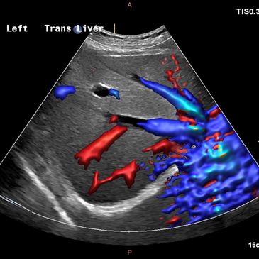 Liver Vascularization image