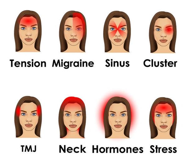 Headaches & Migraines Huntsville