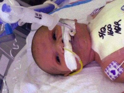 Newborn baby in NICU with medical tubes and monitors attached.