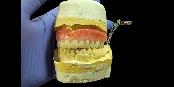 Full acrylic denture resting on stone model set on articulator being held by technician