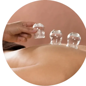 Myofascial Cupping