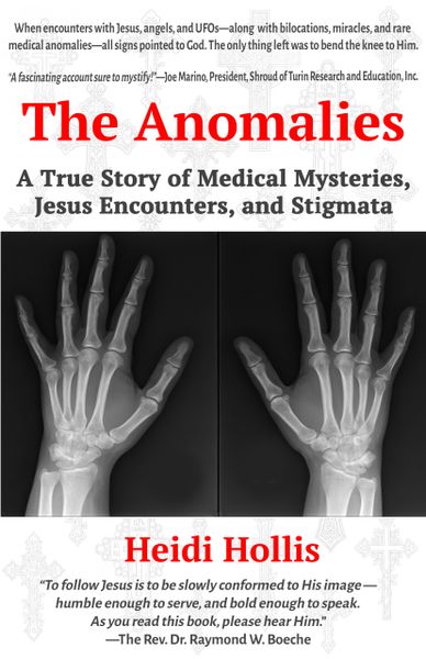 The Anomalies: A True Story of Medical Mysteries, Jesus Encounters, and Stigmata