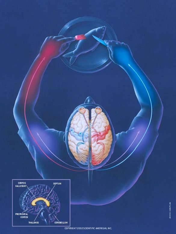 The Split Brain Revisited An Analysis