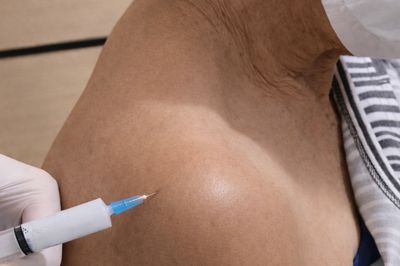 Cortisone injection of a shoulder