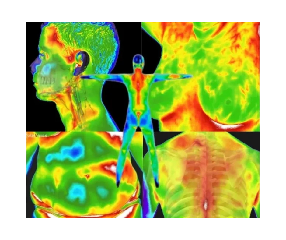 Breast Health Well Life Thermal Imaging