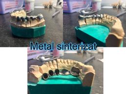 metal sinterizat