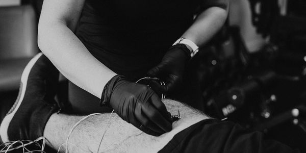 Person receiving acupuncture therapy on their leg from a practitioner wearing gloves.