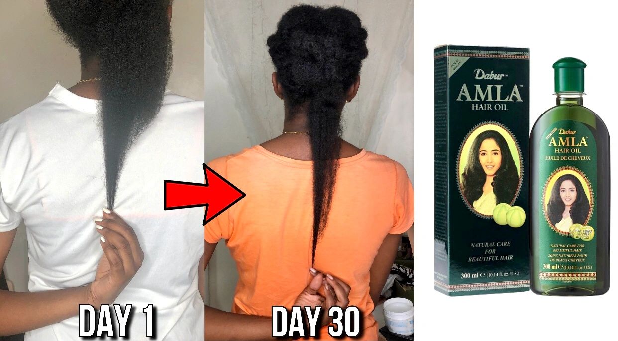 Amla Oil for Hair Growth