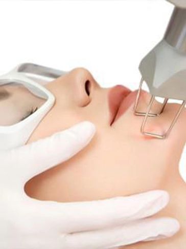 Fractional C02 laser resurfacing treatments