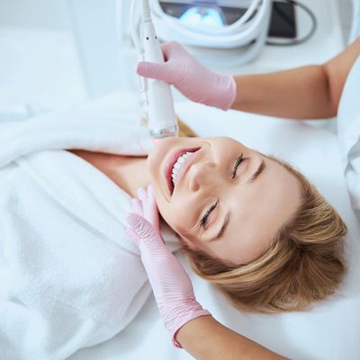 Discomfort from microneedling with radio frequency is minimal