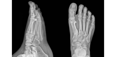 podiatry x-ray