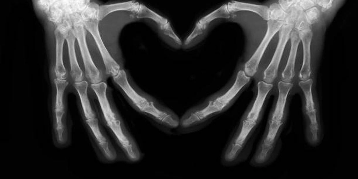 x-ray love