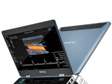 Mindray MX7 Portable Ultrasound Machine