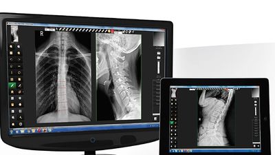 digital x-ray software spectrumview
