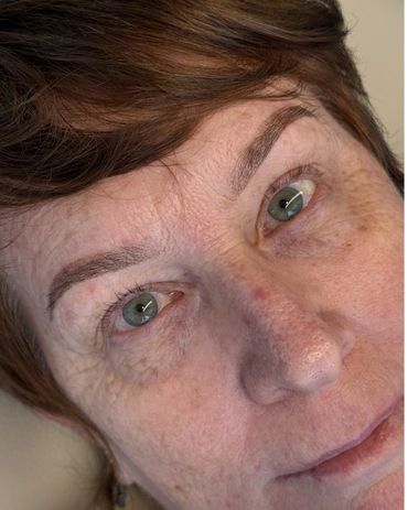 Close-up of a woman's face showing natural skin texture and green eyes.