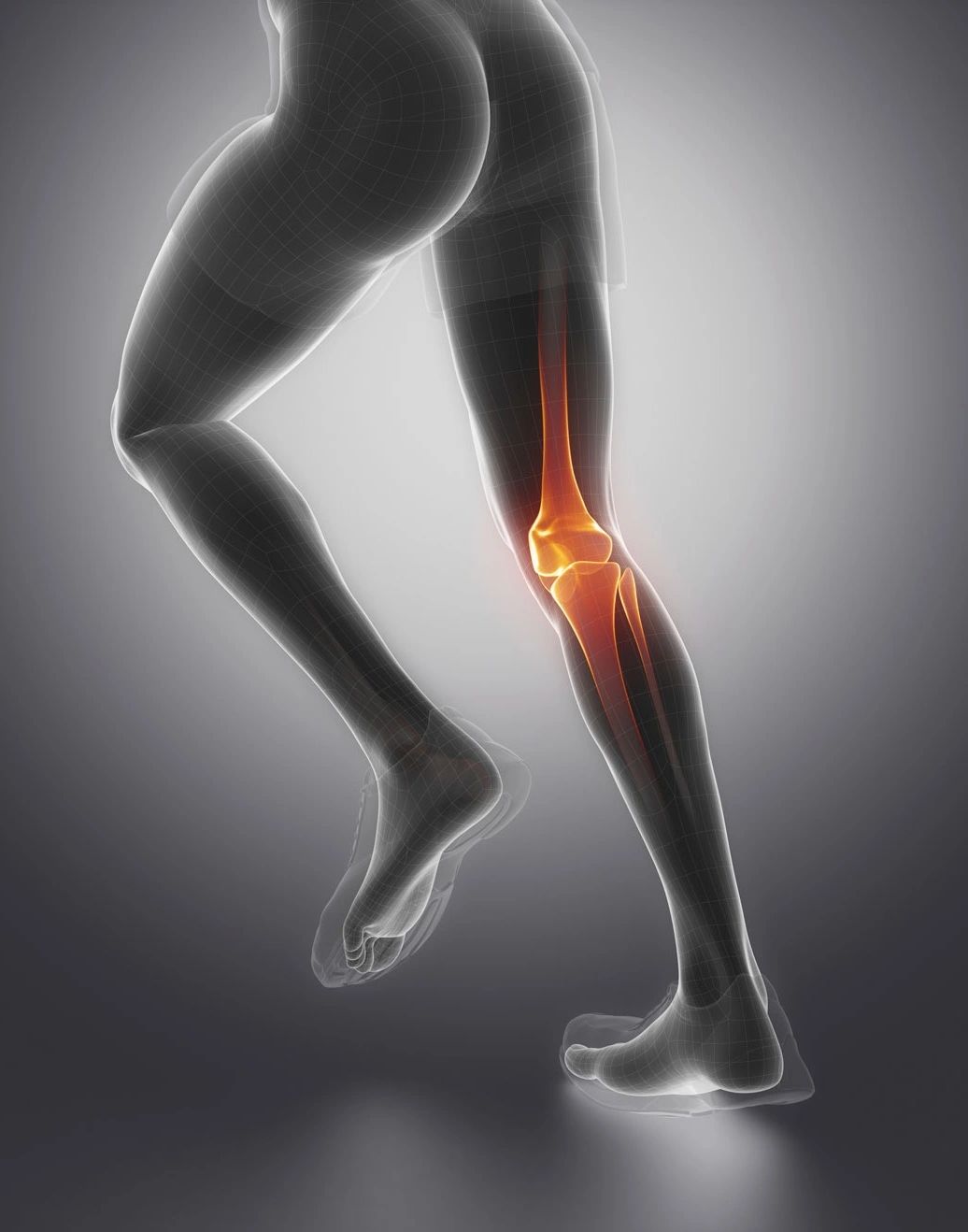 ACL INJURY 8 Essential ACL Rehab Exercises