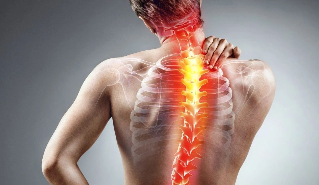 Muscle injury of the upper back