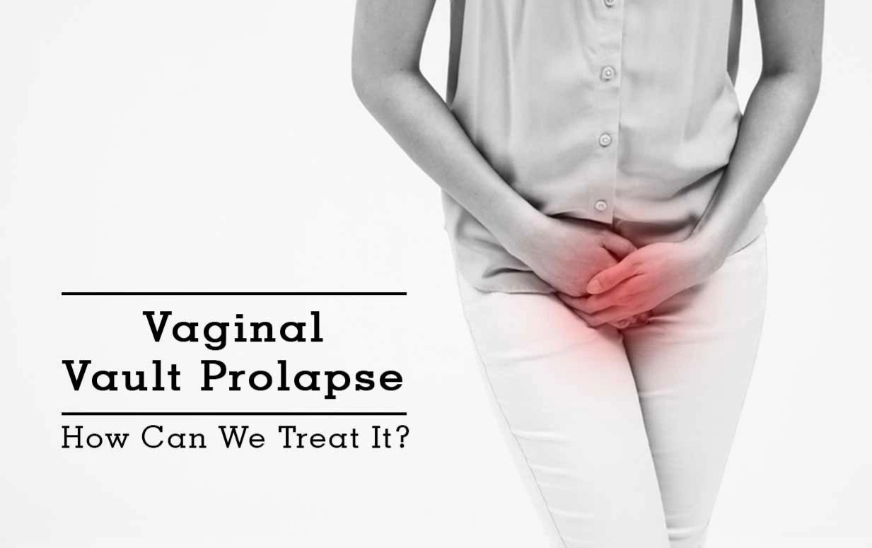 Whats A Vaginalpelvic Prolapse How Can Physiotherapy Help 0136