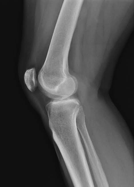 x ray knee injury