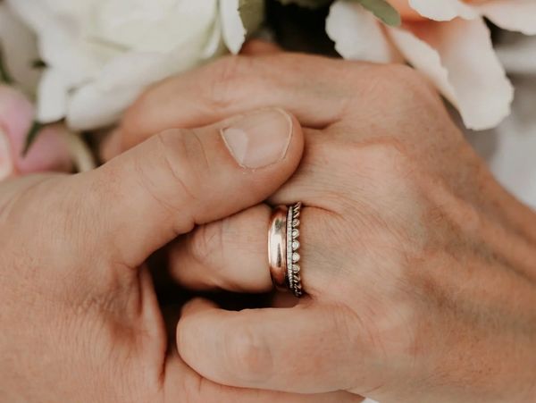 Two hands gently holding each other, showcasing wedding rings.